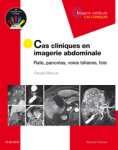 Cas cliniques en imagerie abdominale vignette
