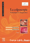 La colposcopie vignette
