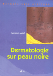Dermatologie sur peau noire vignette