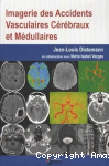 Imagerie des accidents vasculaires cérébraux et médullairess vignette