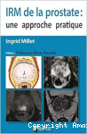 IRM de la prostate vignette